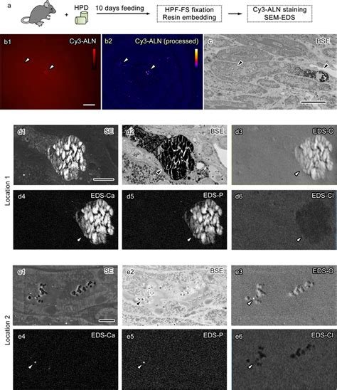 Histological Detection Of Small Calcium Phosphate Particles Caps