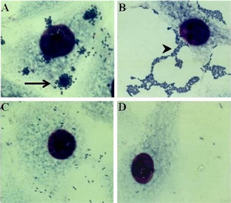 Distinctive Adhesion Patterns Displayed By E Coli Strains On Hela