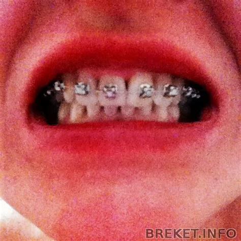 Круглые Зубы Фото – Telegraph