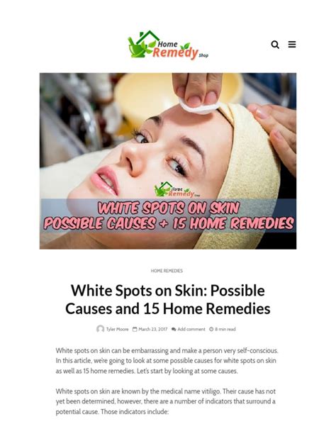 White Spots On Skin - Possible Causes and 15 Home Remedies - Hom | PDF ...