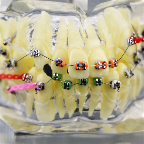 Dental Typodont Orthodontic Treatment Teeth Model Malocclusion Study W