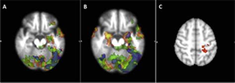 P1051 THE IMPACT OF COGNITIVE TRAINING ON BRAIN ACTIVITY AND