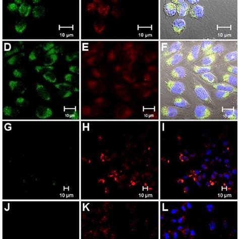 Prekallikrein structure over time after interaction with ECV304 cells ...