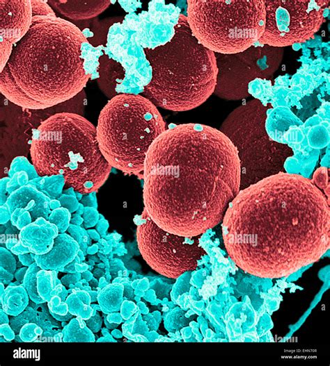 Scanning Electron Micrograph Methicillin Resistant Staphylococcus Hi