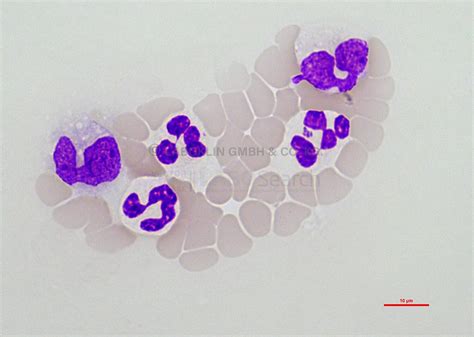 Anaplasma Phagocytophilum Ii Vector Borne Disease