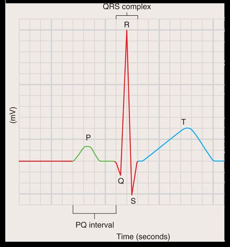 Lab 3 Cardiac Flashcards Quizlet