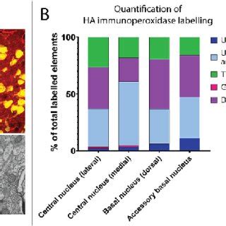 Cellular And Ultrastructural Localization Of Hm Dq Ha In The Nhp