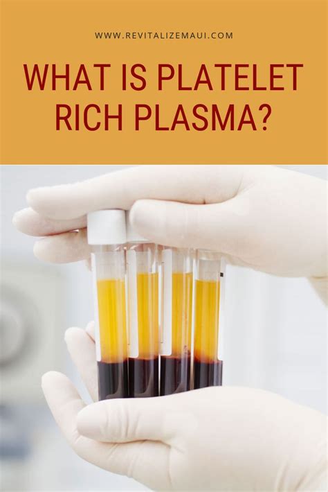 What Is Platelet Rich Plasma Platelet Rich Plasma Platelet Rich