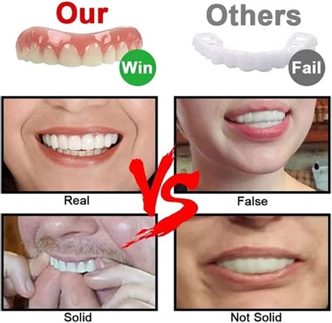 Women's Realistic Veneers Teeth - Upper and Lower Dentures for Missing Teeth