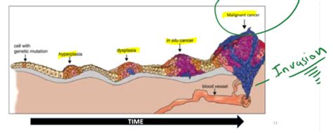 Flashcard Set For Chapter 18 Understanding Skin Cancer And Related Diseases Flashcards Quizlet