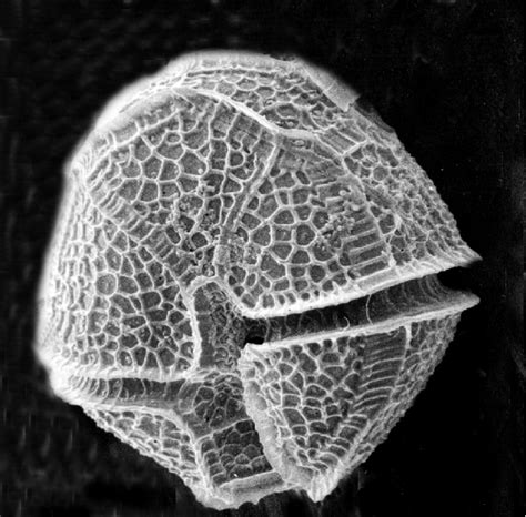 1b Peridinium willei SEM. Photocredit: Kirsten Olrik. | Download Scientific Diagram