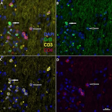 Depicts Co Localization Of Cd Cd And Granzyme B In The Cerebellar