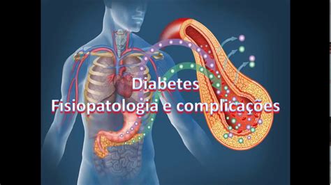 Diabetes Fisiopatologia E Complica Es Parte Introdu O Youtube