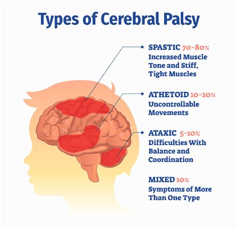 Cerebral Palsy | Ashirwad