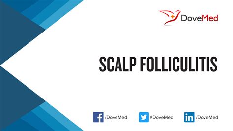 Scalp Folliculitis