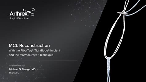 Arthrex Mcl Reconstruction With The Fibertag® Tightrope® Implant And