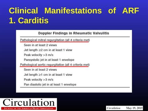 Modified Jones Criteria in the era of Echo