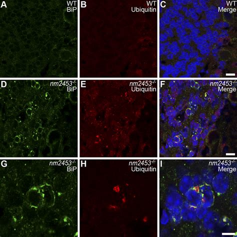 Upregulation Of Grp And Accumulation Of Misfolded Proteins In The