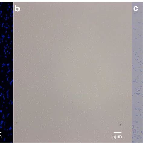 Photomicrographs Of D Solani Ipo 2222 T Using Dapi Download Scientific Diagram