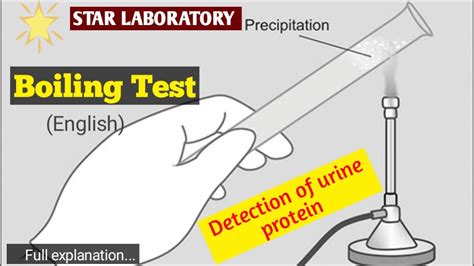 Urine Protein Testurine Testurine Test Proteinurine Test Procedure