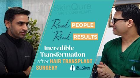 Incredible Transformation After Hair Transplant Surgery Best Hair