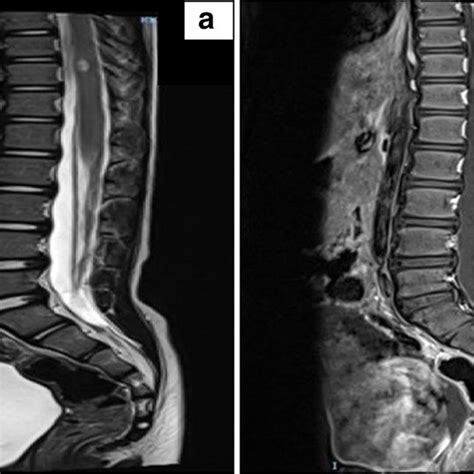 A B T Weighted And Post Contrast T Weighted Sequence Mri Lower