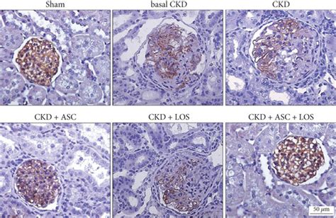 Glomerular Architecture A Illustrative Microphotographs Of Pas