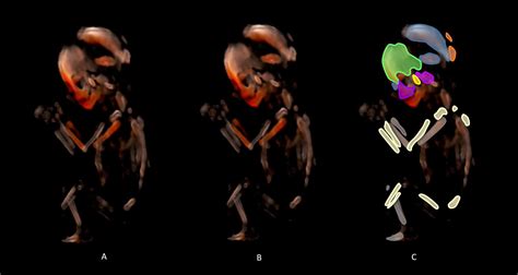 18 Weeks Gestation - 3D Human Development