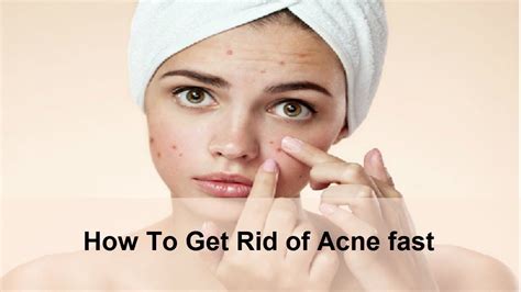 How To Get Rid Of Acne Fast How To Get Rid Of Acne Fast Overnight And Naturally How To Get