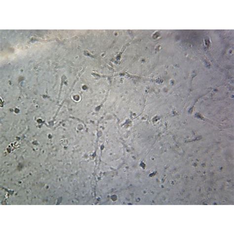 Prepared Microscope Slide Sperm Smear Human