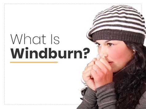 Windburn: Causes, Symptoms, Treatment And Prevention - Boldsky.com