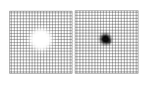 Tela De Amsler Descubra Para Que Serve O Teste E Como Usar Lenscope