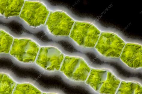 Bambusina Sp Green Alga Lm Stock Image C0216083 Science Photo