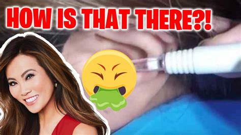 The Most Disgusting Dr Pimple Popper Extractions Part 2 😓🤢 Youtube