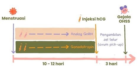 Ohss Ovarian Hyperstimulation Syndrome Bocah Indonesia