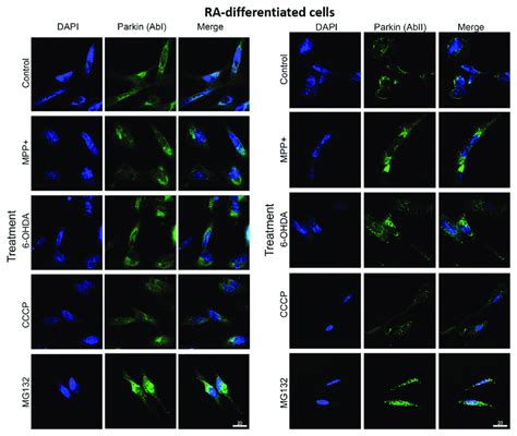 Parkin Isoform Immunolocalization In Ra Differentiated Sh Sy Y Cells