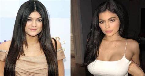 Kylie Jenner Y El Secreto Detr S De Todas Las Cirug As Que Se Ha Hecho