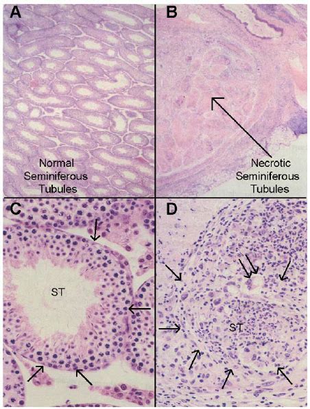 Histopathology Of Autoimmune Orchitis A C Cross Section Of Normal