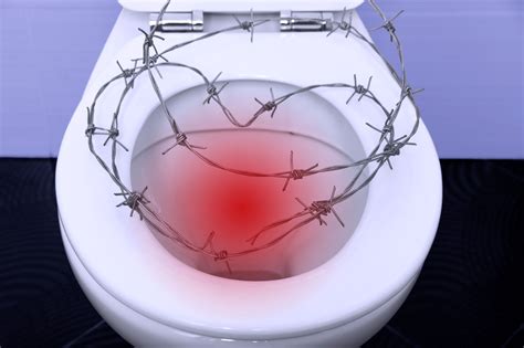 Fissura Anal O Que O Que Causa E Como Tratar Coe