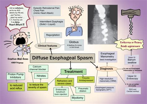 Diffuse Esophageal Spasm DES Creative Med Doses