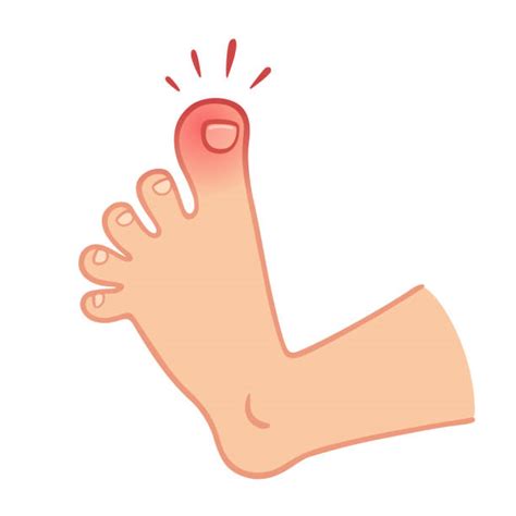 Toenail Pain Causes Treatments Buoy Health | atelier-yuwa.ciao.jp