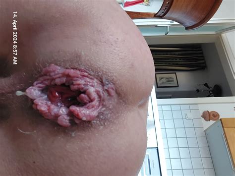 Open Ass 6 Nude Pics XHamster