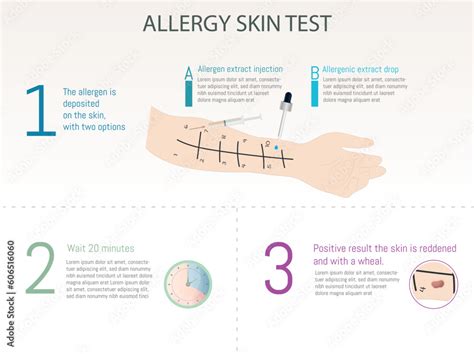 Allergy skin test: drop or intradermal test and process. Stock Vector ...