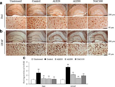 Immunohistochemical Findings Iba1 Positive Microglial Cells And