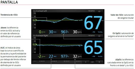 Plataforma De Monitoreo Root Masimo Pv Equip