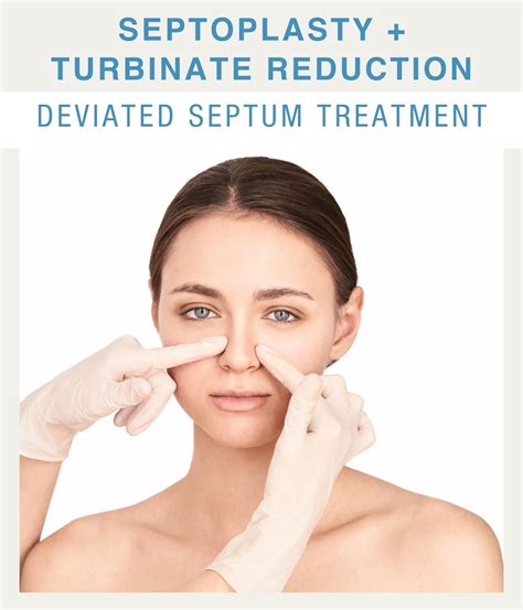 SEPTOPLASTY TURBINATE REDUCTION DEVIATED SEPTUM TREATMENT, 44% OFF