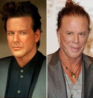 Mickey Rourke Plastic Surgery - Paperblog