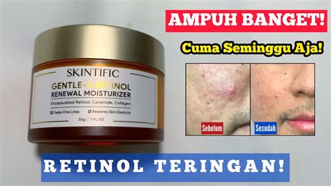 RETINOL TERINGAN REVIEW JUJUR SKINTIFIC GENTLE A RETINOL RENEWAL