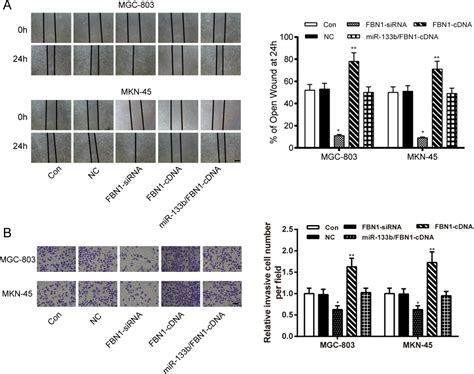 Mir 133b Inhibits Proliferation And Invasion Of Gastric Cancer Cells By