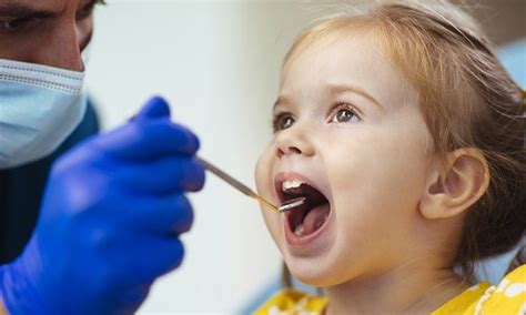 Cavities in Kids: Causes, Symptoms, Risk Factors & Prevention | Focus ...